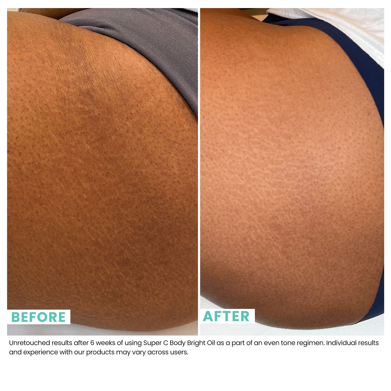 Woman's skin before and after using USRX Super C Body Bright Oil