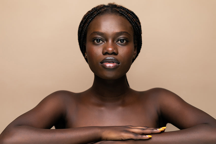 woman with hyperpigmentation, post-inflammatory hyperpigmentation or PIH